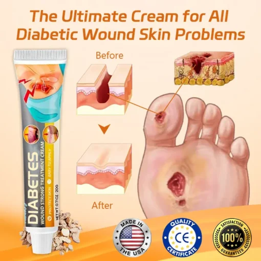 BBOJI™ Diabetes Wound Strong Treatment Cream