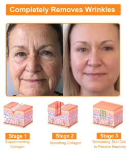 BBOJI™ Powerful All-Body Skin Treatment Cream