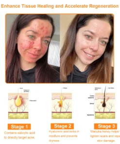 BBOJI™ Powerful All-Body Skin Treatment Cream