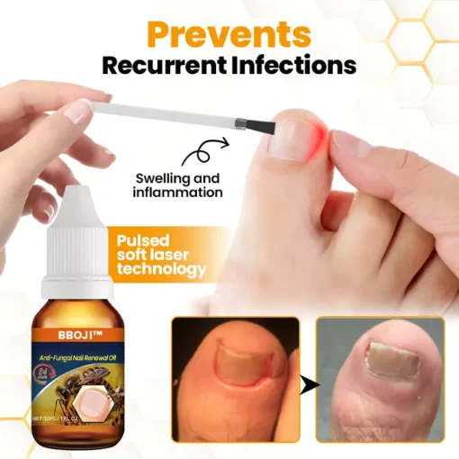 BBOJI™ Wasp venom Anti-Fungal Nail Renewal Oil