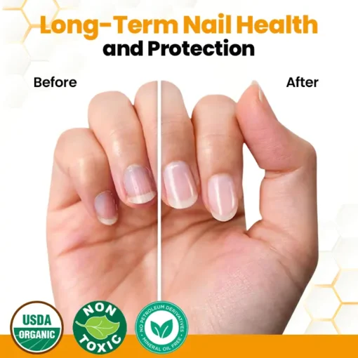 BBOJI™ Wasp venom Anti-Fungal Nail Renewal Oil