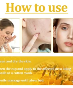BBOJI™ Bee Venom Skin Treatment Cream
