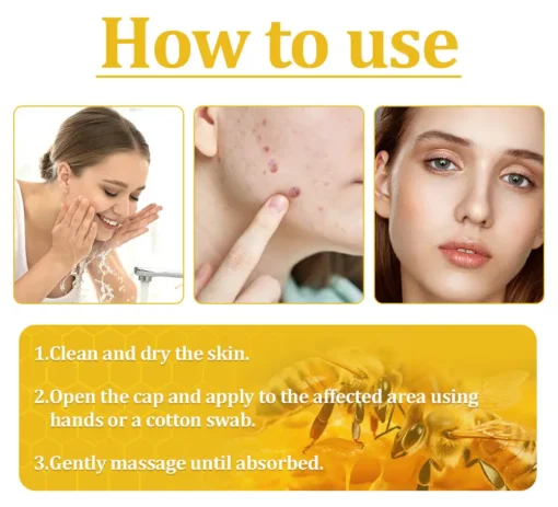 BBOJI™ Bee Venom Skin Treatment Cream
