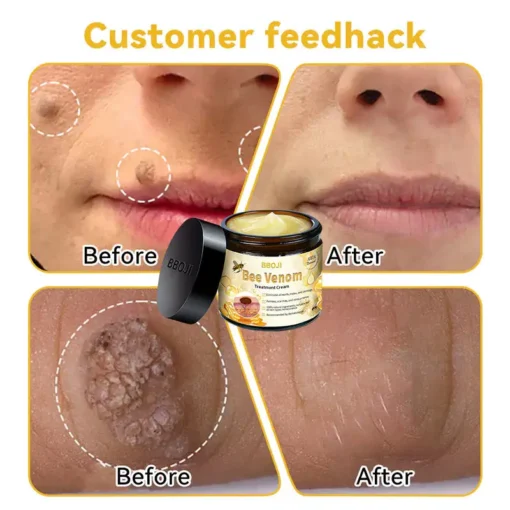 BBOJI™ Bee Venom Skin Treatment Cream