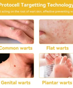 BBOJI™ Bee Venom Skin Treatment Cream