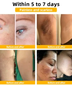 BBOJI™ Bee Venom Skin Treatment Cream