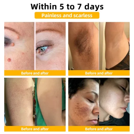 BBOJI™ Bee Venom Skin Treatment Cream