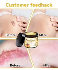 BBOJI™ Bee Venom Skin Treatment Cream