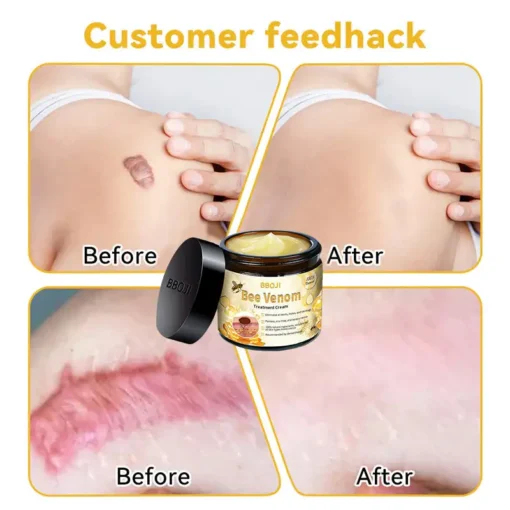 BBOJI™ Bee Venom Skin Treatment Cream