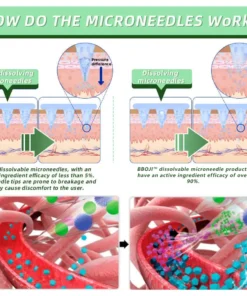 BBOJI™ SMGT-GLP-1 Nano Microneedle Patch