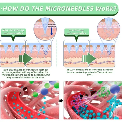 BBOJI™ SMGT-GLP-1 Nano Microneedle Patch