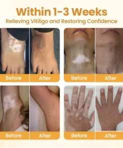 BBOJI™ VitiClear Pro Bee Toxin Cream