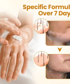 BBOJI™ VitiClear Pro Bee Toxin Cream