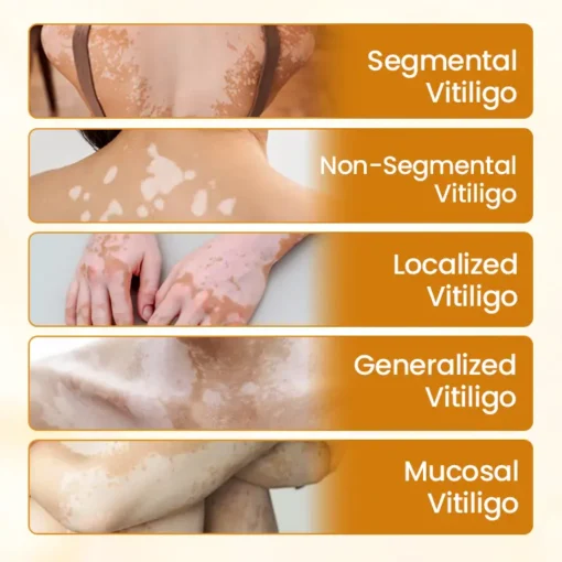 BBOJI™ VitiClear Pro Bee Toxin Cream