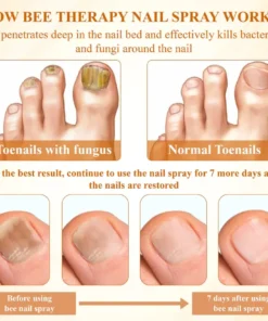 BBOJI® Fungiclear Bee Therapy Nail Spray