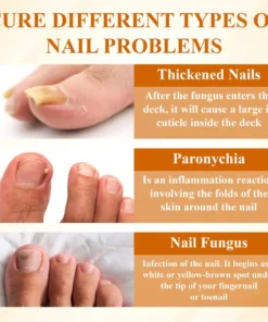 BBOJI® Fungiclear Bee Therapy Nail Spray