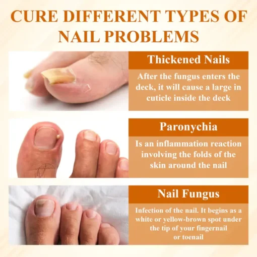 BBOJI® Fungiclear Bee Therapy Nail Spray