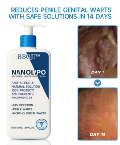 BBOJI™ NanoLipo HPV Genital warzen-Eraser creme Plus