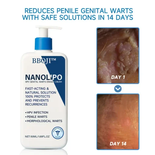 BBOJI™ NanoLipo HPV Genital warzen-Eraser creme Plus