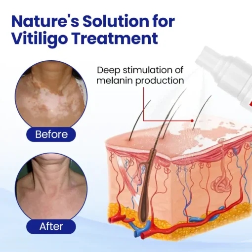 BBOJI™ VitiClear Herbal Spray