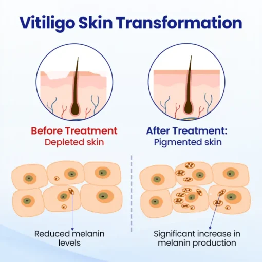 BBOJI™ VitiClear Herbal Spray