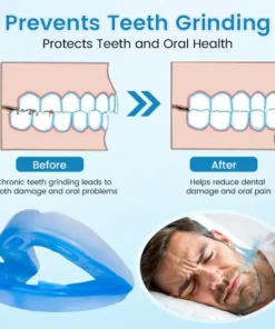 BBOJI™ Adjustable Anti-Snoring Mouthpiece