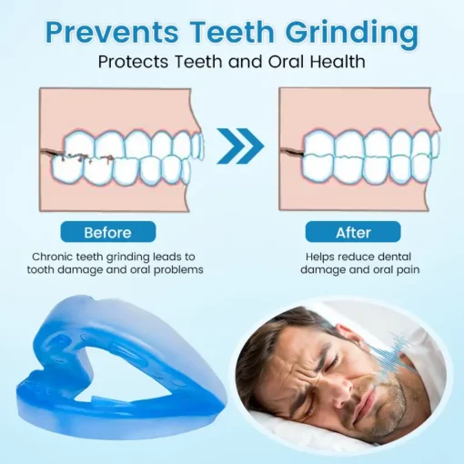 BBOJI™ Adjustable Anti-Snoring Mouthpiece