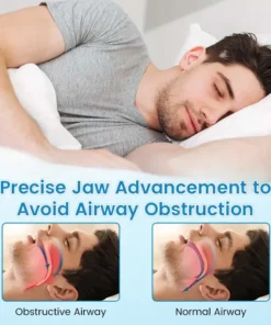 BBOJI™ Adjustable Anti-Snoring Mouthpiece