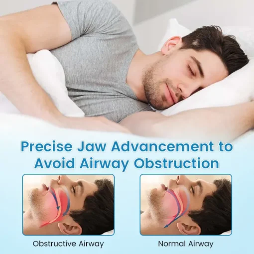 BBOJI™ Adjustable Anti-Snoring Mouthpiece