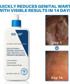 BBOJI® HPV Genital Warts Eraser Cream Ultra