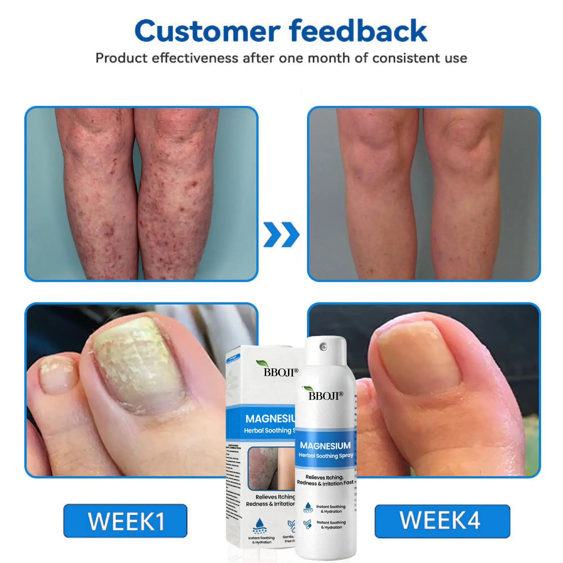 BBOJI® Magnesium Herbal Soothing Spray