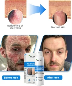 BBOJI® Magnesium Herbal Soothing Spray