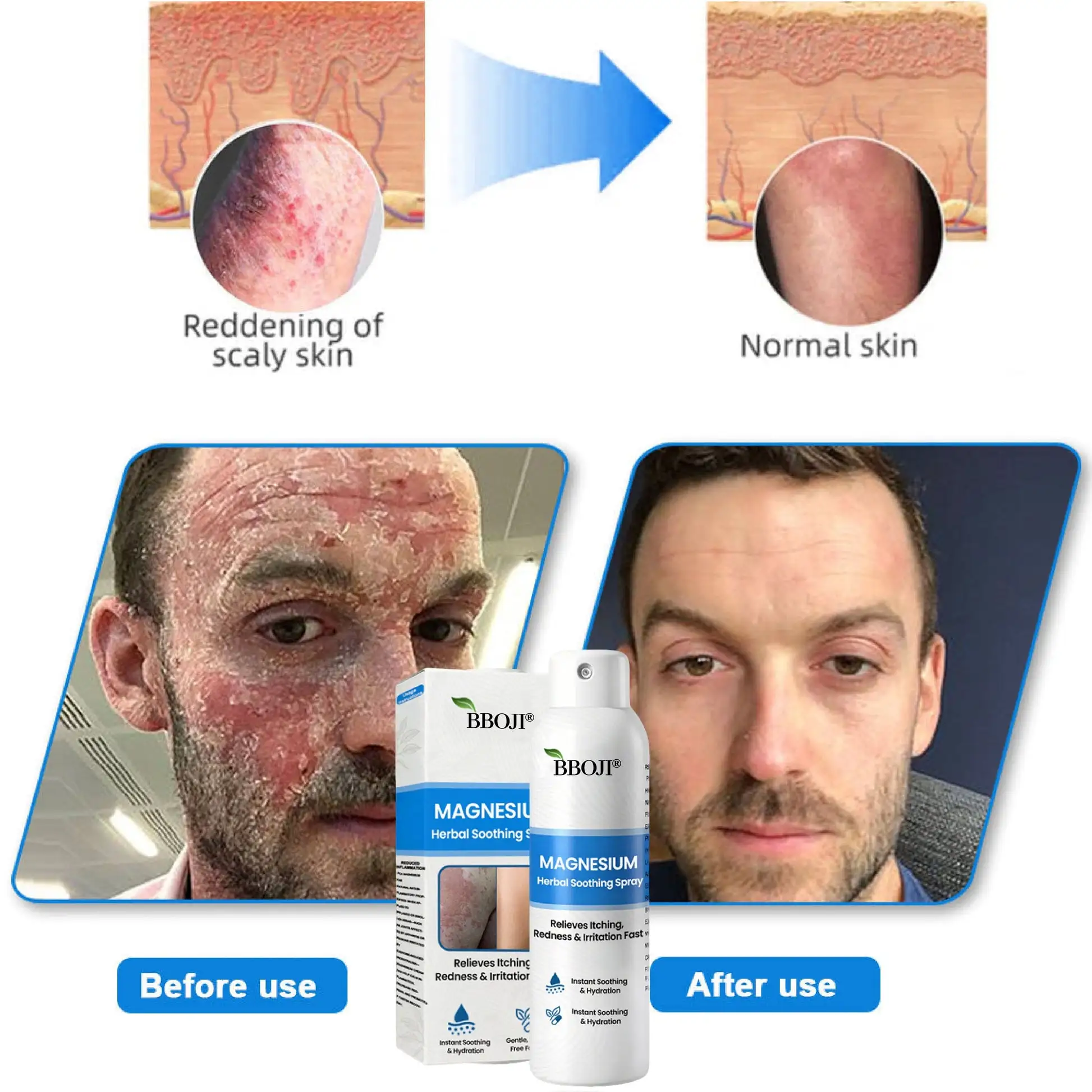 BBOJI® Magnesium Herbal Soothing Spray