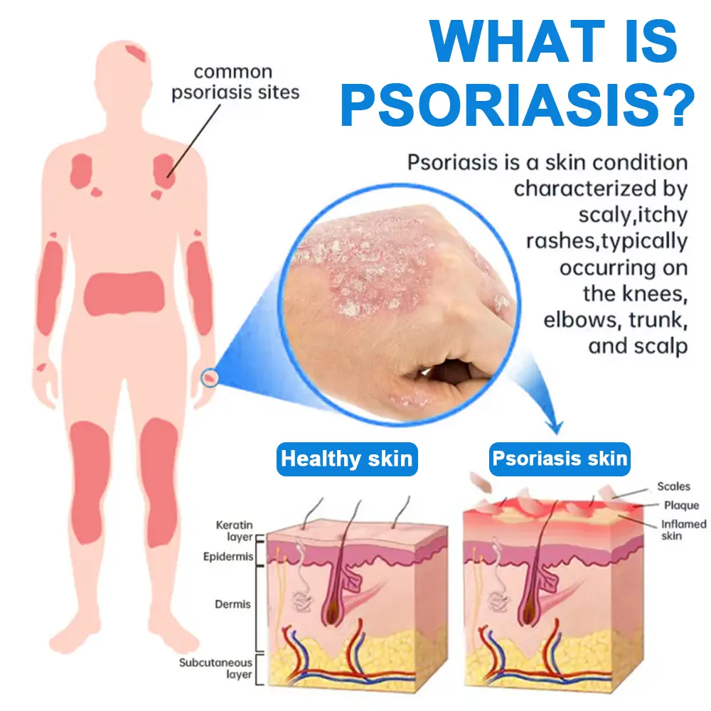 BBOJI® Magnesium Herbal Soothing Spray