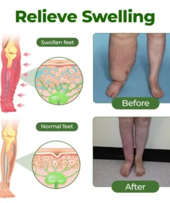 BBOJI® Professional Leg Circulation Cream