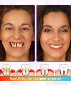 BBOJI® BeeRenew Advanced Gum Healing Toothpaste