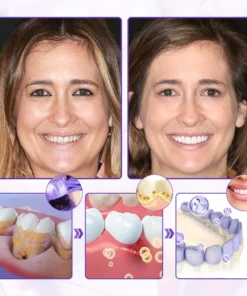 BBOJI® BeeRenew Advanced Gum Healing Toothpaste