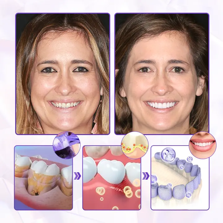 BBOJI® BeeRenew Advanced Gum Healing Toothpaste