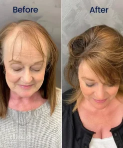 BBOJI® Maximum Strength 5% Minoxidil Fast-Action Hair Growth Serum