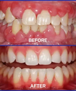 BBOJI™BEE TOXIN Toothpaste