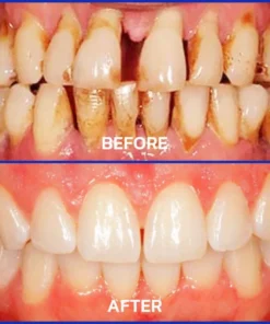 BBOJI™BEE TOXIN Toothpaste