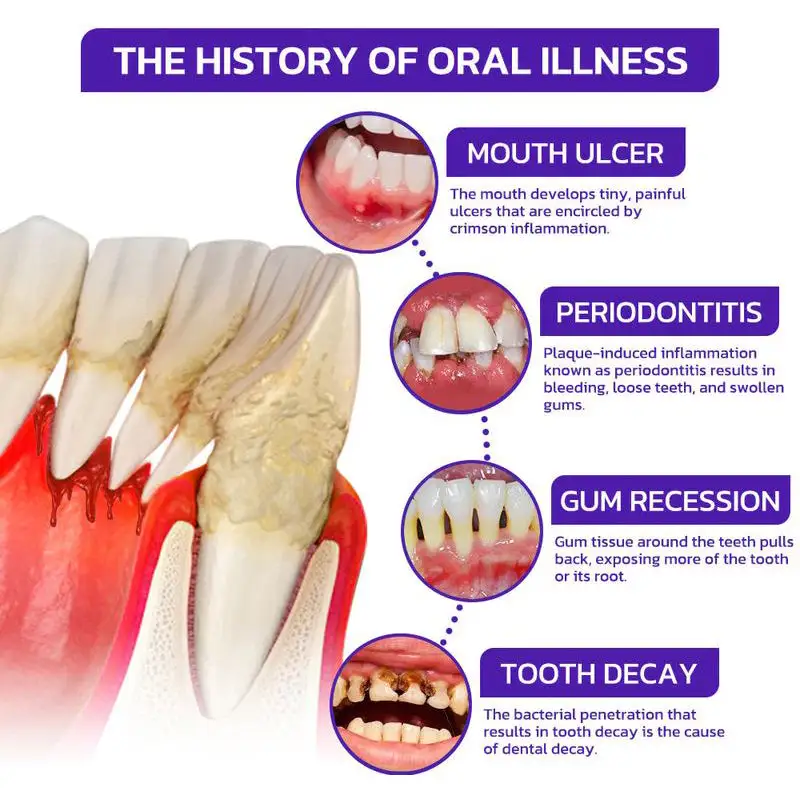 BBOJI™BEE TOXIN Toothpaste