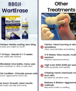 BBOJI® WartErase Cryo Freeze Spray
