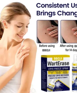 BBOJI® WartErase Cryo Freeze Spray