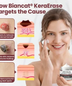 BBOJI®KeraErase Dual-Action Renewal Cream