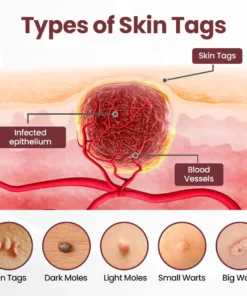 BBOJI®KeraErase Dual-Action Renewal Cream