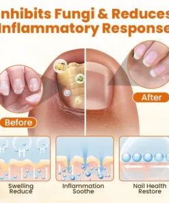 BBOJI® Bee venom Nail fungus Repair Spray