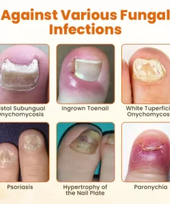 BBOJI® Bee venom Nail fungus Repair Spray