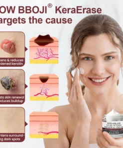 BBOJI® KeraErase Dual-Action Renewal Cream