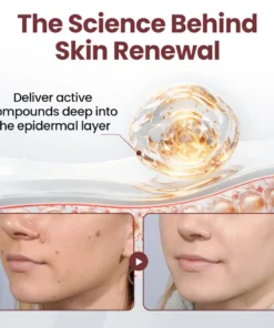 BBOJI® KeraErase Dual-Action Renewal Cream